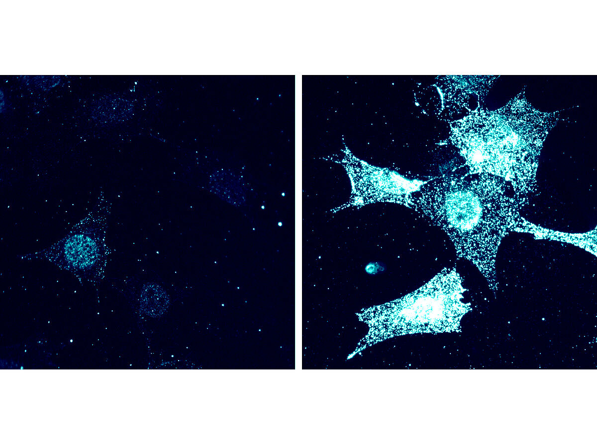 Unterdrückung von Tumoren: Regulationsmechanismus entdeckt