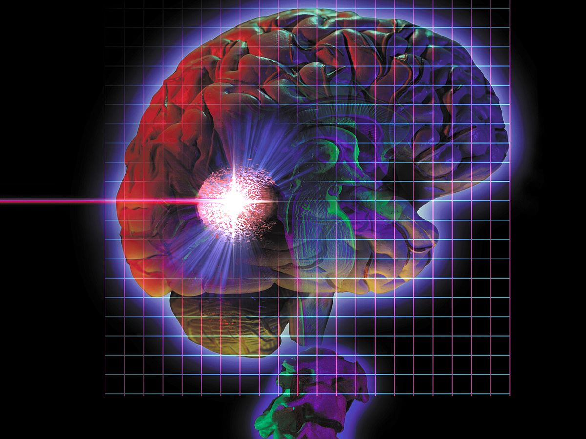Präzisere Gehirn-Operationen per Laserstrahl