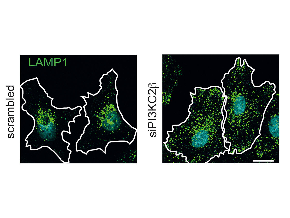 New therapeutic attack point: Scientists find off-switch for the mTor complex