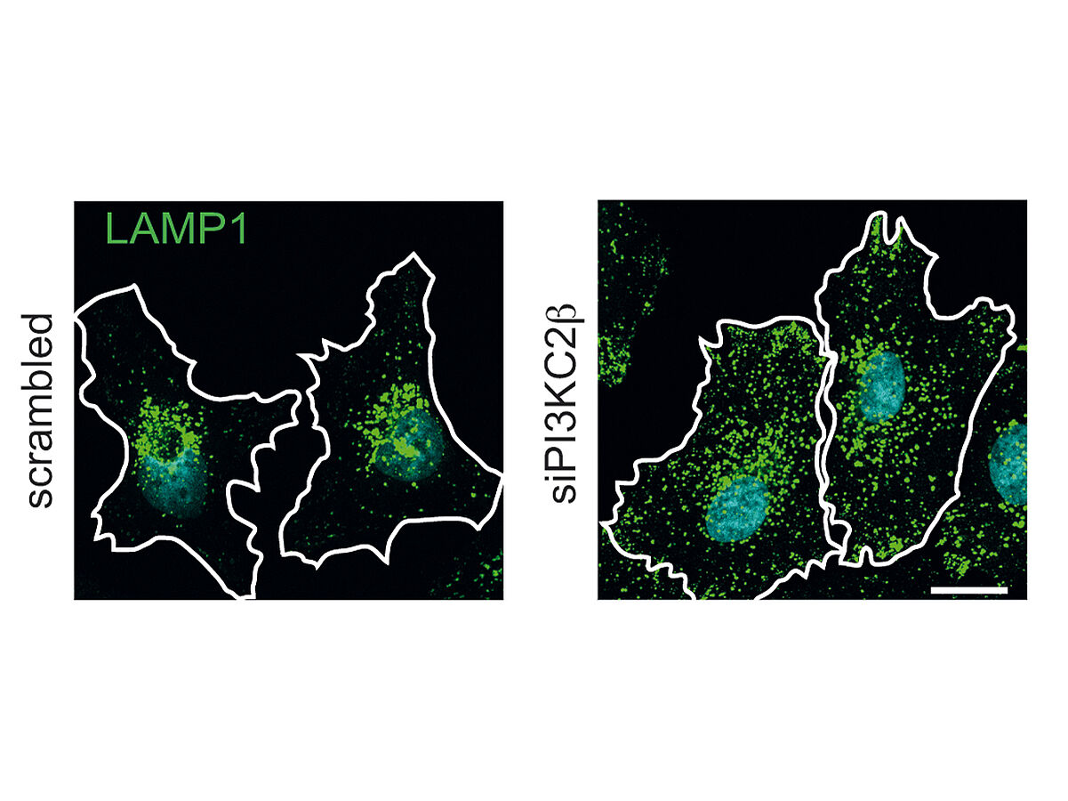 Neuer therapeutischer Angriffspunkt: Forscher finden „Aus“-Schalter für mTor-Komplex