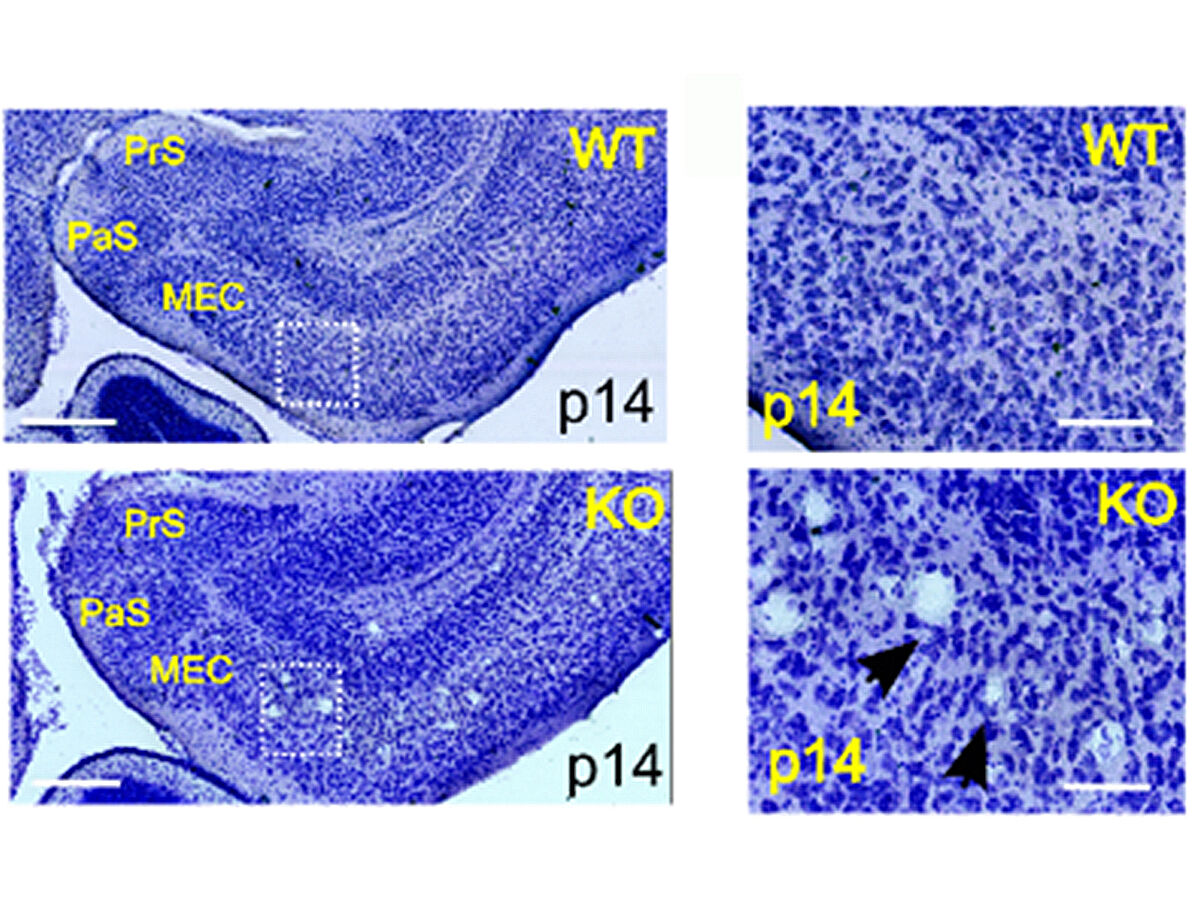 Neue Rolle der Autophagosomen bei Neurodegeneration entschlüsselt