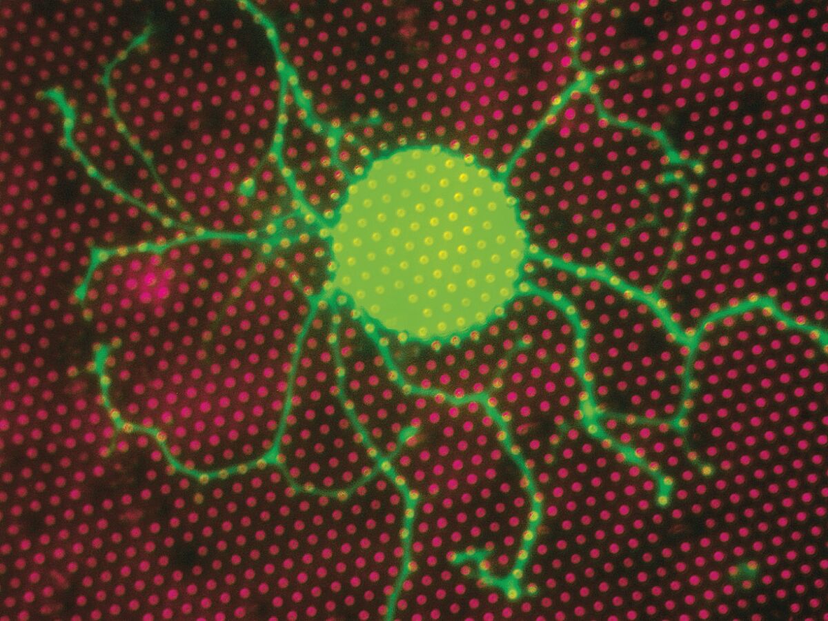 Neuer Wirkstoff lindert neuropathischen Schmerz