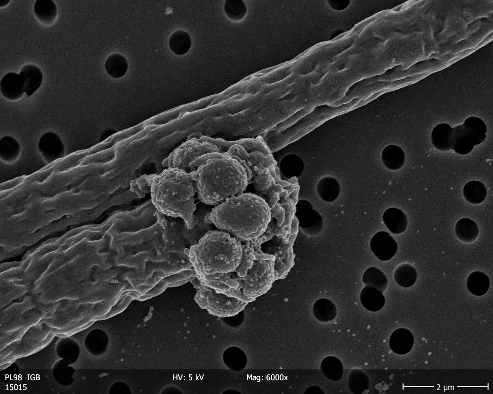 Genetische Vielfalt schützt vor Krankheiten