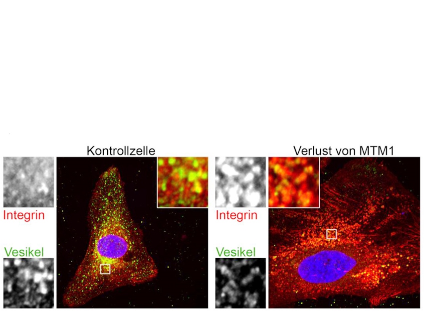 Muscle weakness: Berlin scientists unravel defects in rare hereditary disease myotubular myopathy