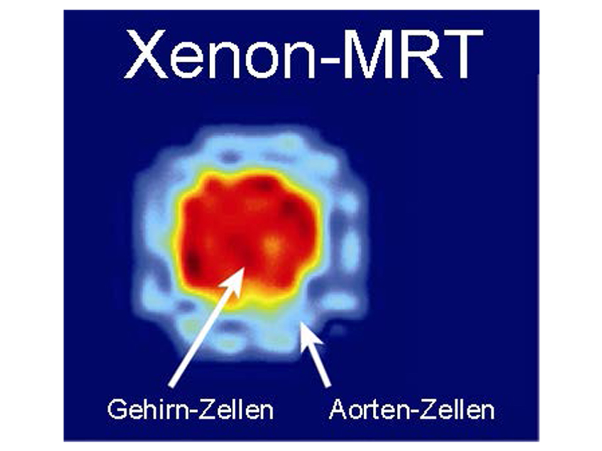 Paket abgeliefert: Neue Kontrastmittel für Kernspin-Diagnostik überwinden Blut-Hirn-Schranke
