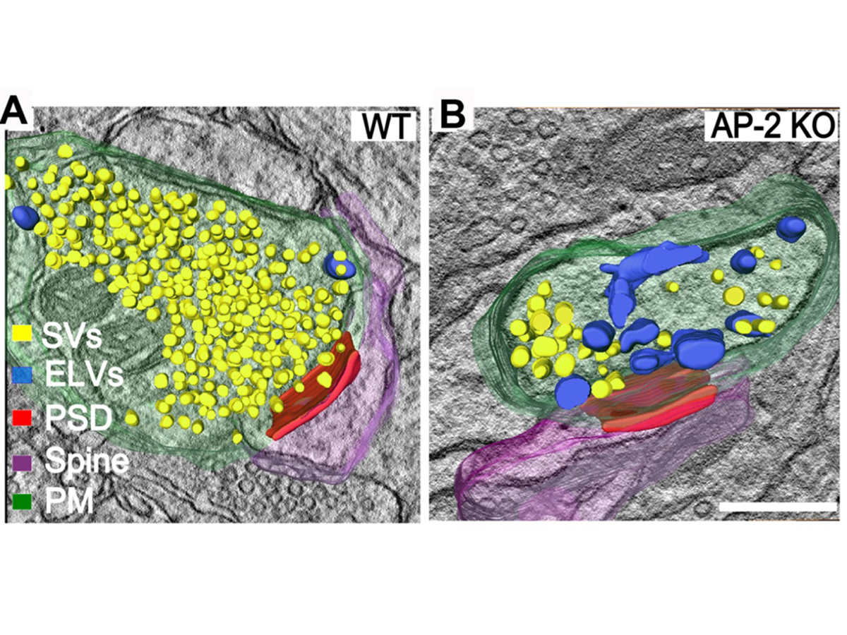 Turbocharger for nerve cells: operation of ADHS gene investigated